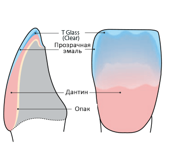 Building-up with T Glass layers 